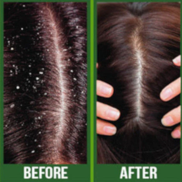 Difeel Premium Castor Plus Tea Tree - Pro-Growth + Scalp Care Premium Hair Oil 75ml - Image 4
