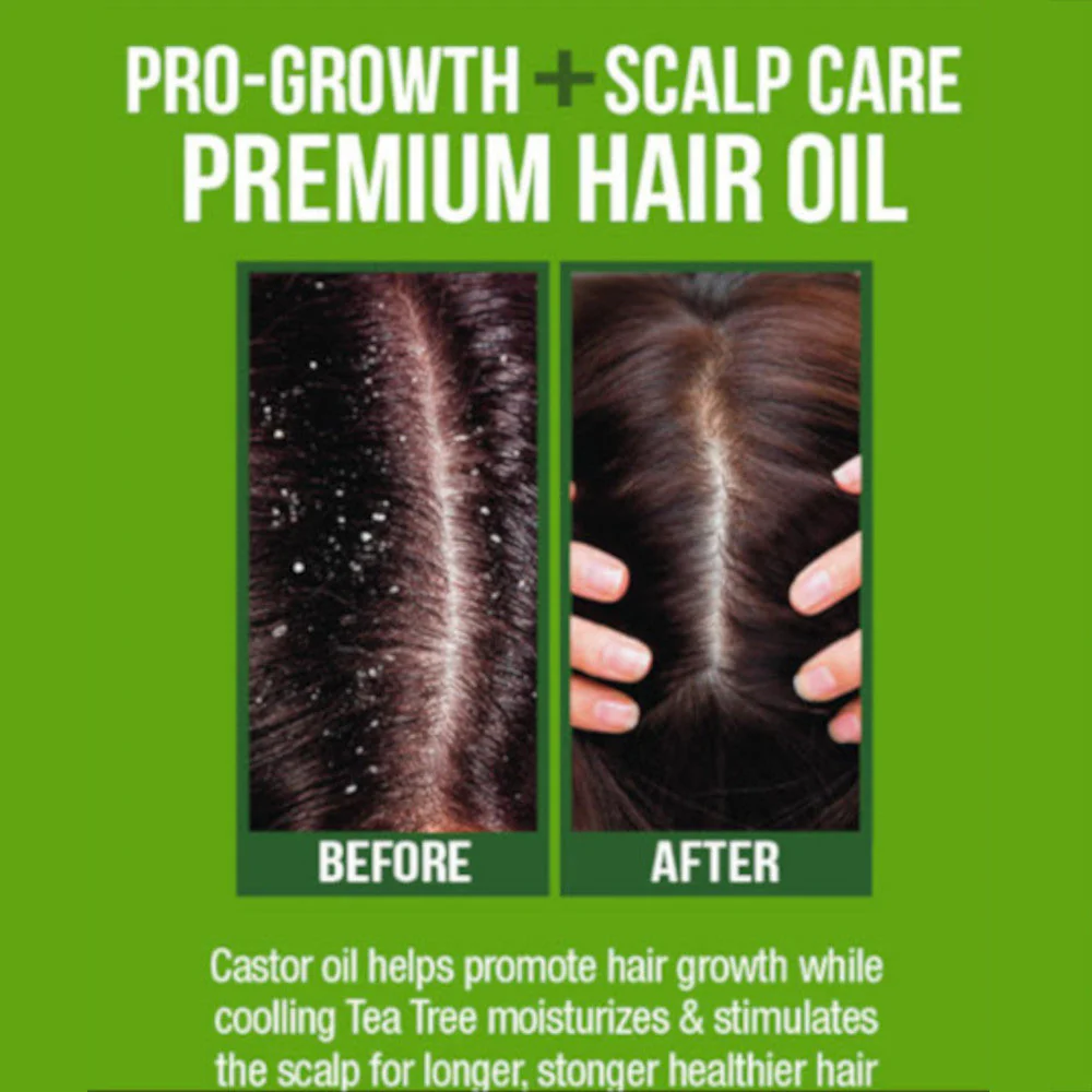 Difeel Premium Castor Plus Tea Tree - Pro-Growth + Scalp Care Premium Hair Oil 75ml - Image 5