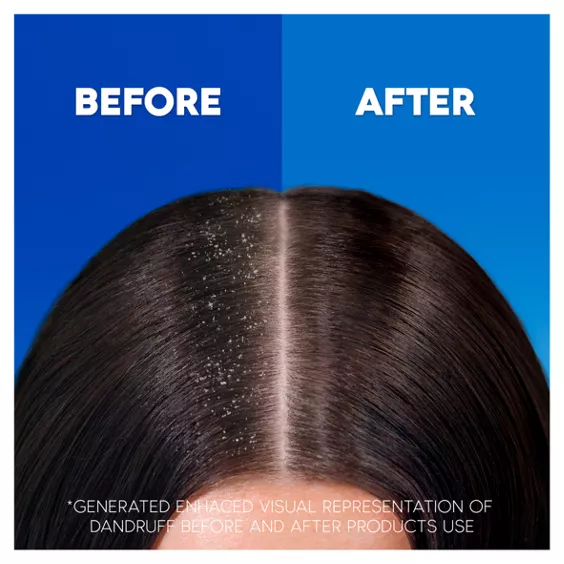 Head & Shoulders Citrus Fresh 2in1 Anti Dandruff Shampoo And Conditioner For Greasy Hair 400ml - Image 3