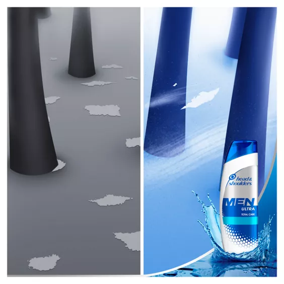 Head & Shoulders Men Total Care Anti Dandruff 2in1 Shampoo 400ml - Image 3