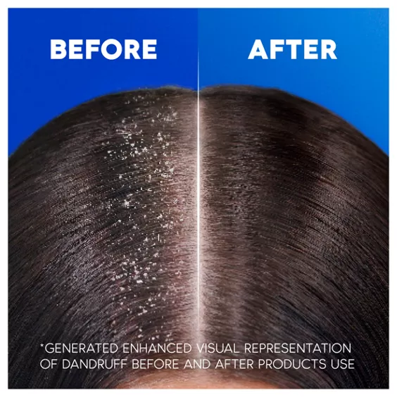 Head & Shoulders Smooth & Silky Anti-Dandruff Shampoo for Frizzy Hair 400ml - Image 3