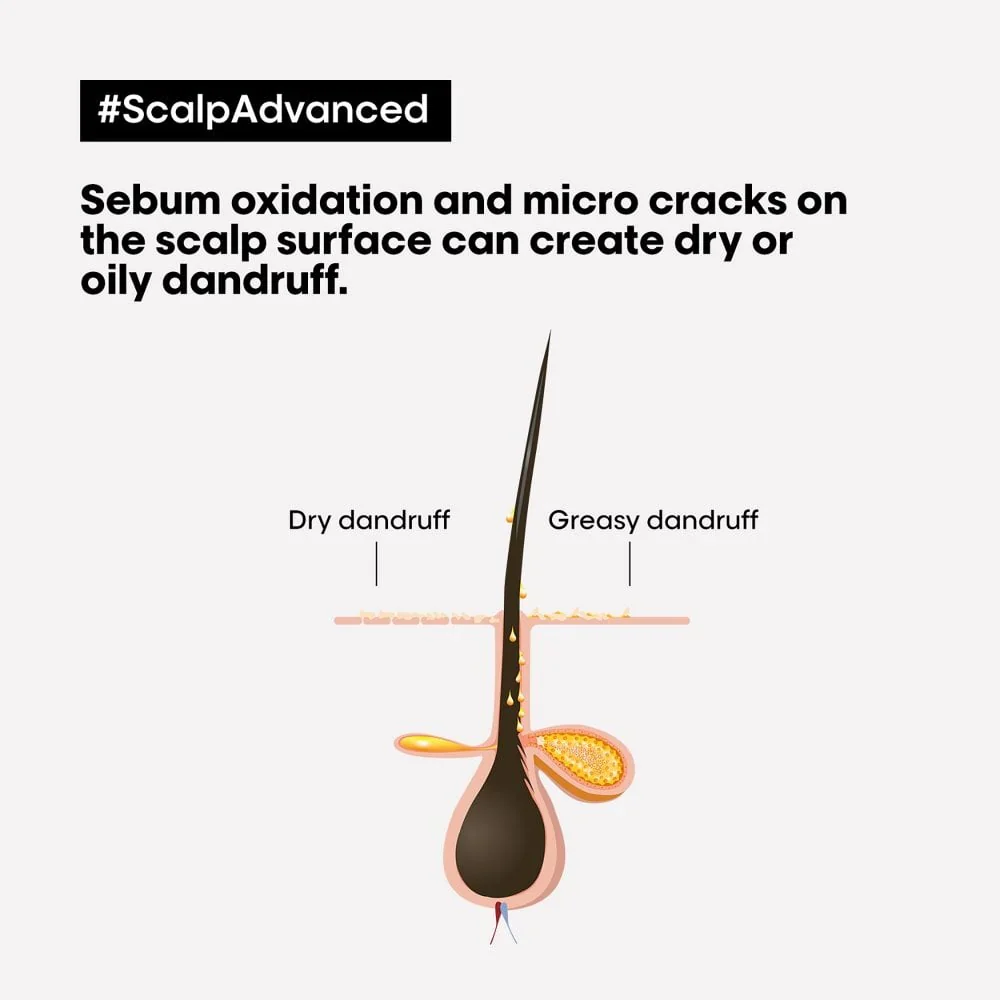 L'Oreal Professionnel Serie Expert Scalp Advanced Anti-Dandruff Dermo-Clarifier Shampoo 500ml - Image 5