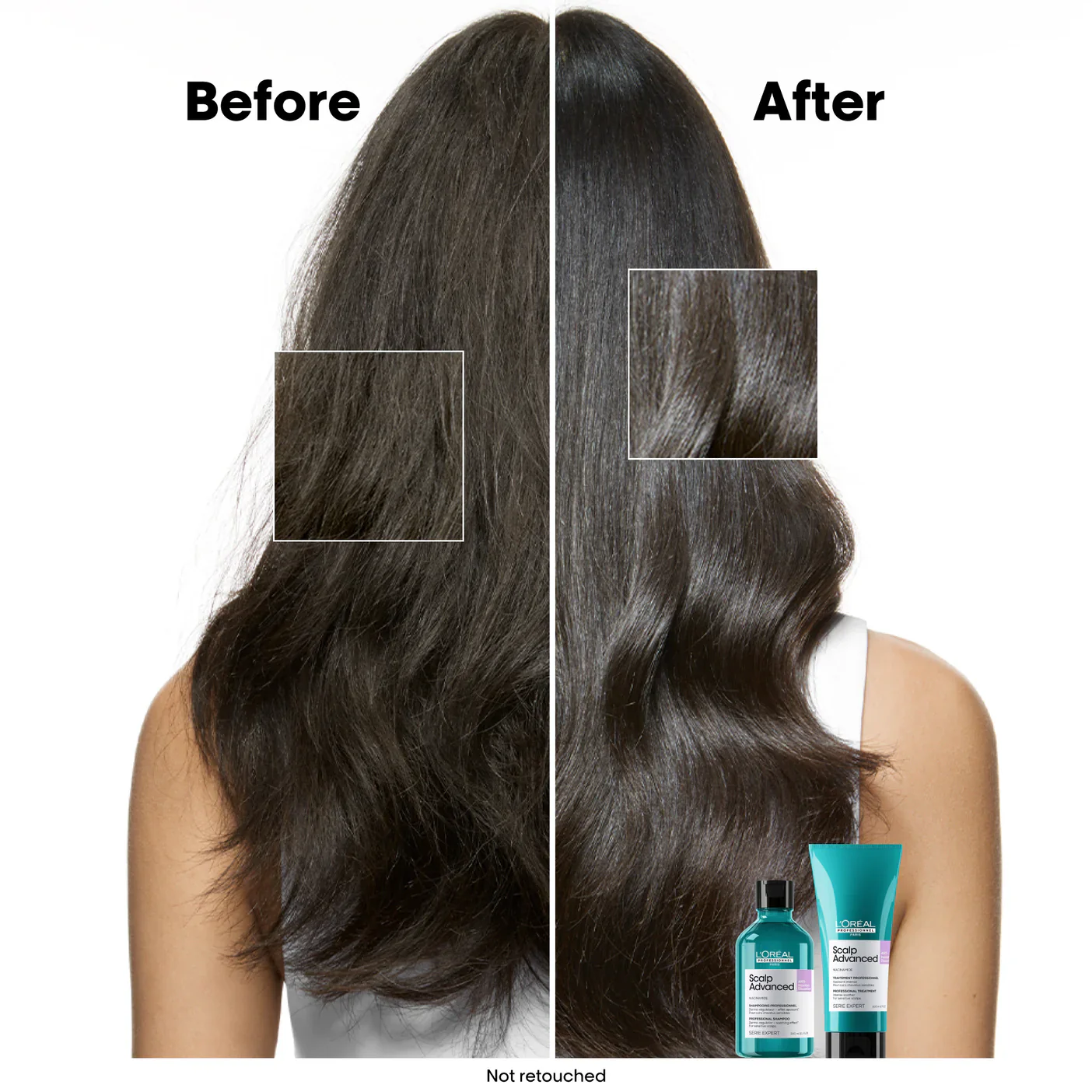 L'Oreal Professionnel Serie Expert Scalp Advanced Anti-Discomfort Dermo-Regulator Shampoo 300ml - Image 4