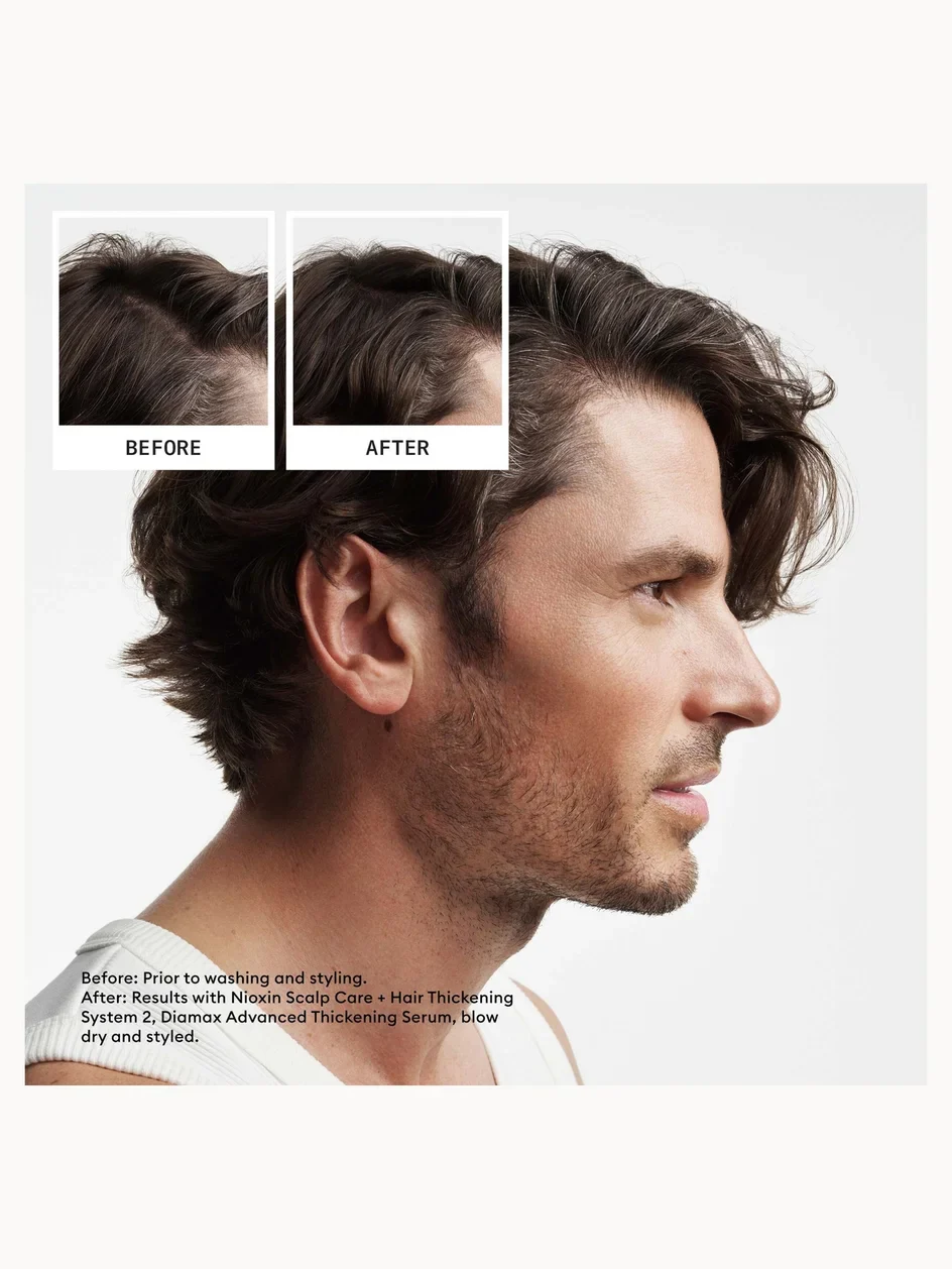 Nioxin System 2 Trial Kit for Natural Hair Thinning - Image 5
